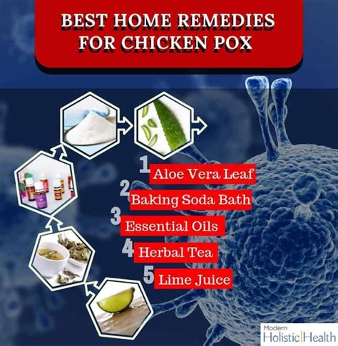 Top 11 Natural Remedies for Chicken Pox | Modern Holistic Health