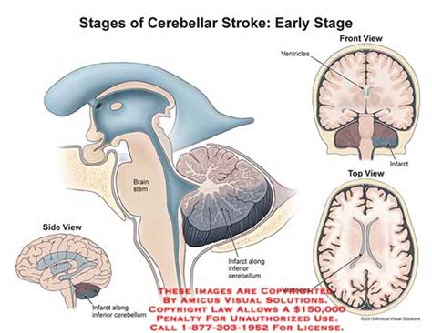 Medical Exhibits, Demonstrative Aids, Illustrations and Models