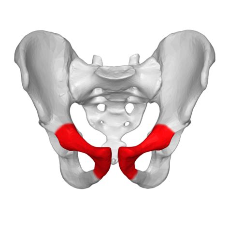 Osteitis Pubis - Physiopedia