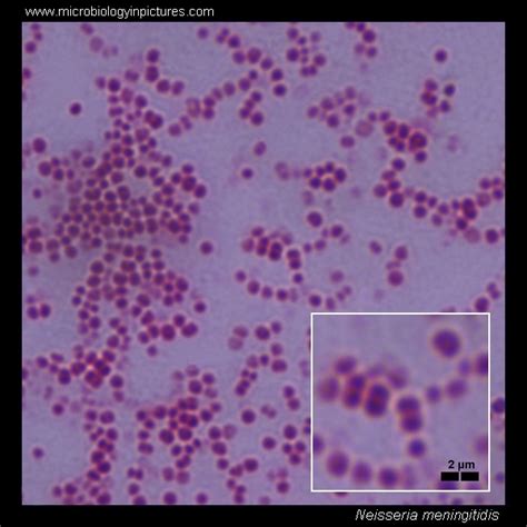 Neisseria Gram Stain