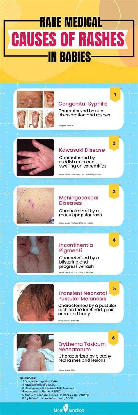 22 Different Causes Of Rashes In Babies And Their Prevention – NBKomputer