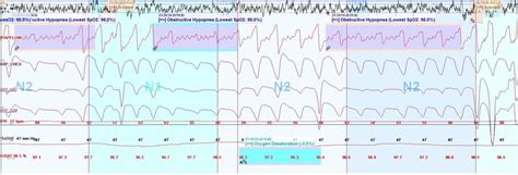 Screen shot (2 min) of selected information derived from a... | Download Scientific Diagram