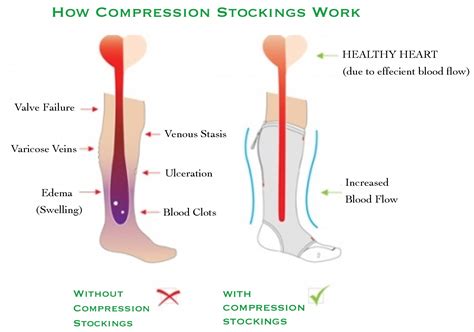 Beginner's Guide to Compression Socks 2024 - Benefits & Types