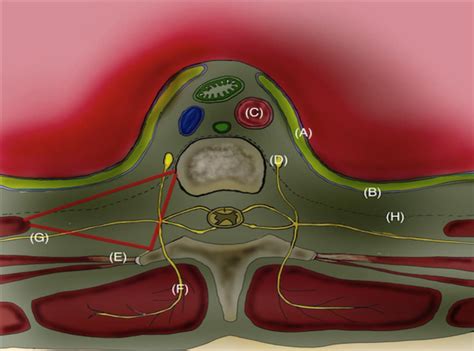 Ultrasound-Guided Paravertebral Block : WFSA - Resources