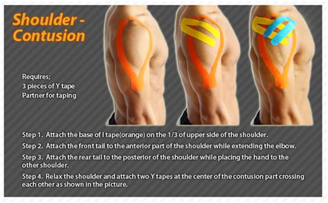 Kinesiology taping instructions for shoulder contusions #ktape #ares #shoulder | Kinesiology ...