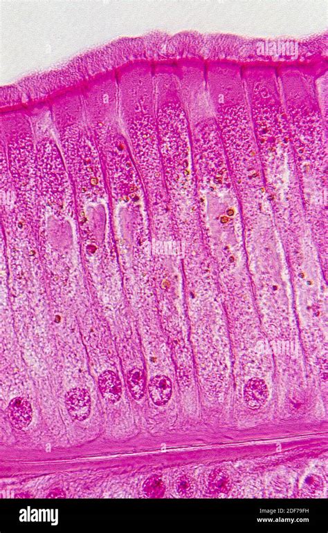 Ciliated Epithelium Labeled