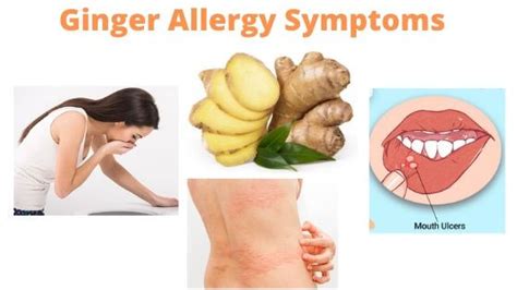 Ginger Allergy Symptoms - Fruits Facts