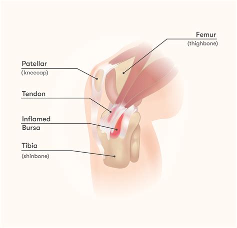 Why Does My Inner Knee Hurt? Injury and Pain Relief Guide