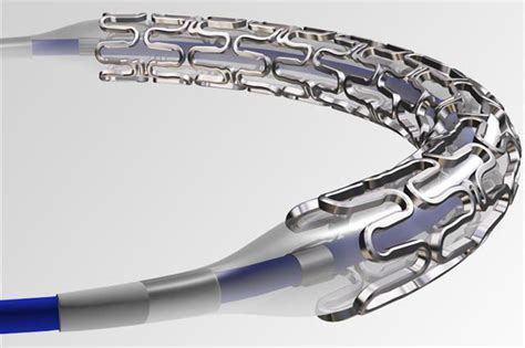 Drug Eluting Stents Coating | Siansonic Technology