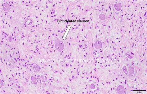 Dorsal Root Ganglion Cell