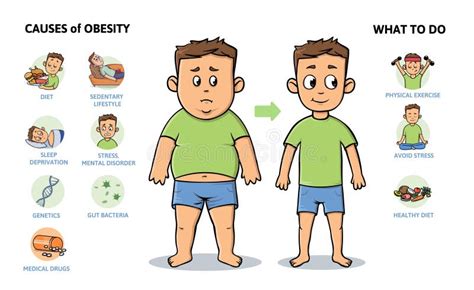 Obesity: Causes and Effects Stock Illustration - Illustration of ...