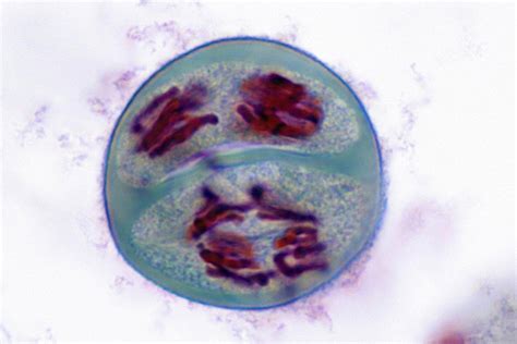 Overview of the Stages of Meiosis