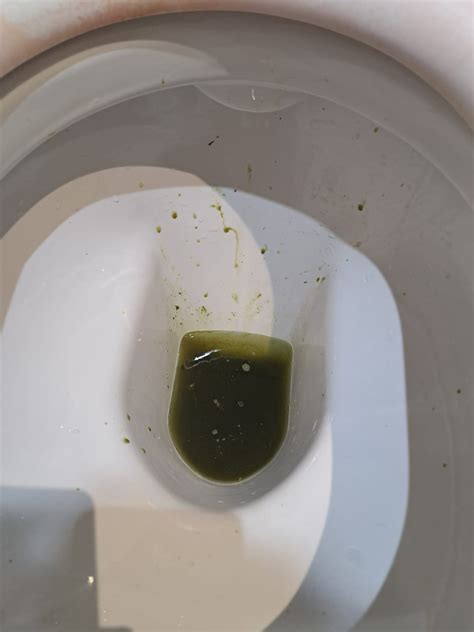 Green Diarrhea : r/medical