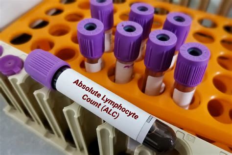 Absolute Lymphocyte Count Test: Normal Range, Purpose, Preparation