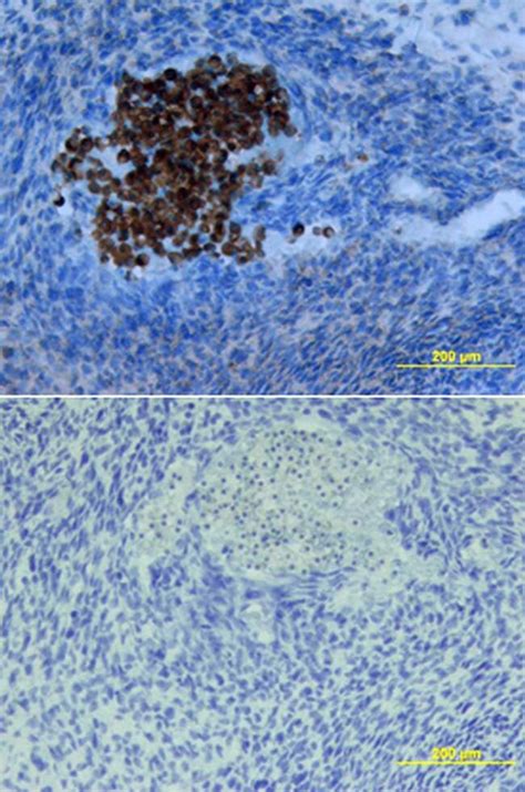 Sclerostin Antibody (PA5-46977)