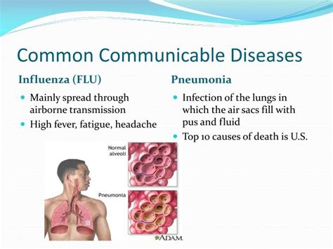 Different Types Of Communicable Diseases