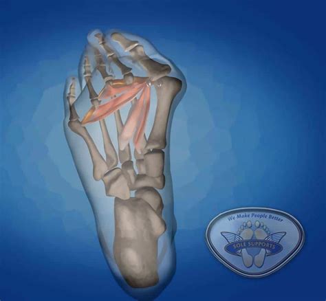 Causes and Treatment of Bunion Pain