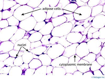 Adipose Tissue Histology - Adipose tissue (labels) - histology slide