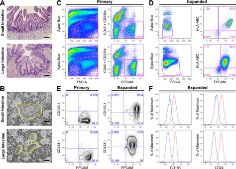 In vitro expanded primary epithelial cells from human fetal small and ...