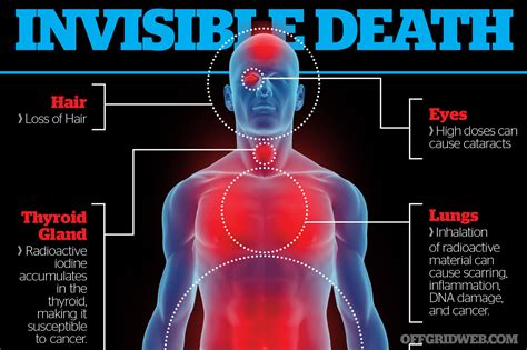 Radiation Poisoning Effects On Human