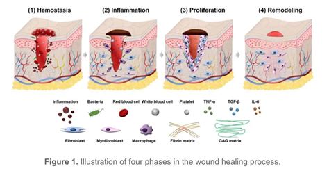 Healing Hacks: 4 Picture-Perfect Stages of Wound Healing | Credihealth