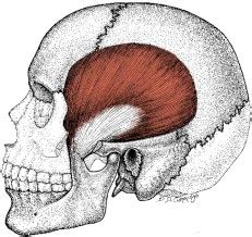 Temporalis Trigger Points and Referred Pain Patterns ...