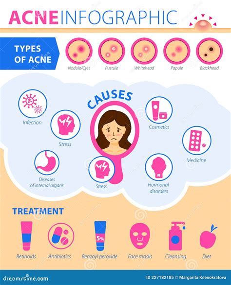 Types of Acne, Causes of the Disease, Treatment. Infographics of Acne ...