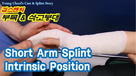 Short Arm Splint Intrinsic Position - YouTube