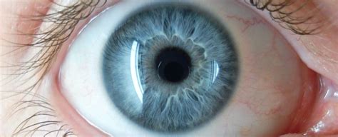 Syphilis Is Attacking People's Eyeballs, And This Issue Is on The Rise Around The World ...