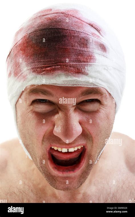 Bandage on blood wound head Stock Photo - Alamy