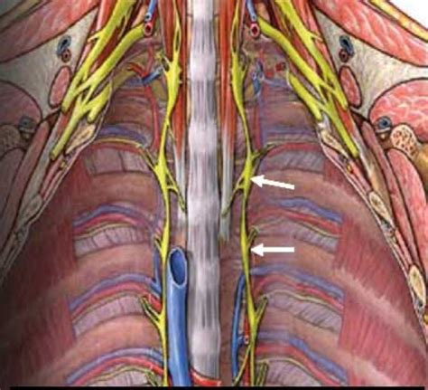 Thoracoscopic (VATS) Sympathectomy for Hyperhidrosis | Department of Cardiothoracic Surgery ...