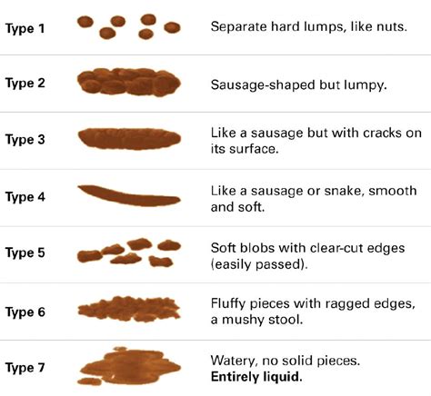 Keith Siau On Twitter: Bristol Stool Scale And Overflow Diarrhoea ...