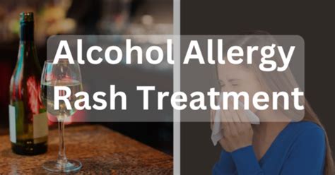 Alcohol Allergy Rash Treatment Complete Guide | United Recovery | United Recovery California