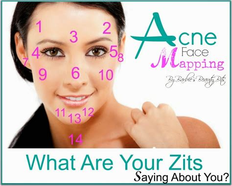 Acne Face Mapping: What Are Your Zits Saying About You? | Barbie's Beauty Bits