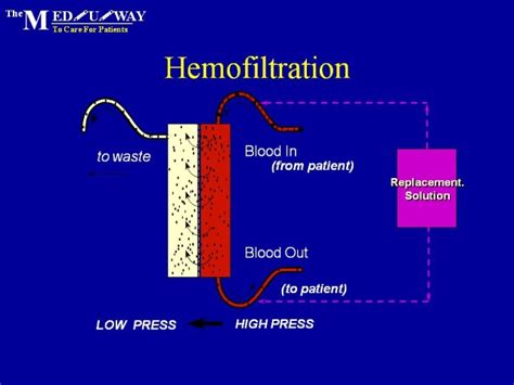 Hemofiltration; Arteriovenous Hemofiltration; CAVH; Hemofiltration, Continuous Arteriovenous ...