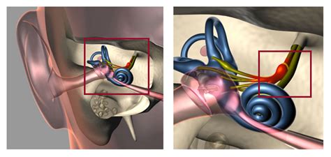 Vestibular Neuritis: Symptoms, Causes, Diagnosis & Treatment