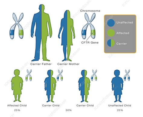 Cystic Fibrosis Mutation, Illustration - Stock Image C027/6882 - Science Photo Library