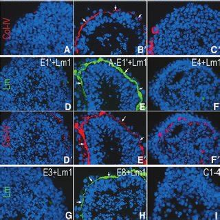 Laminin domains contributing to basement membrane assembly. ␥... | Download Scientific Diagram