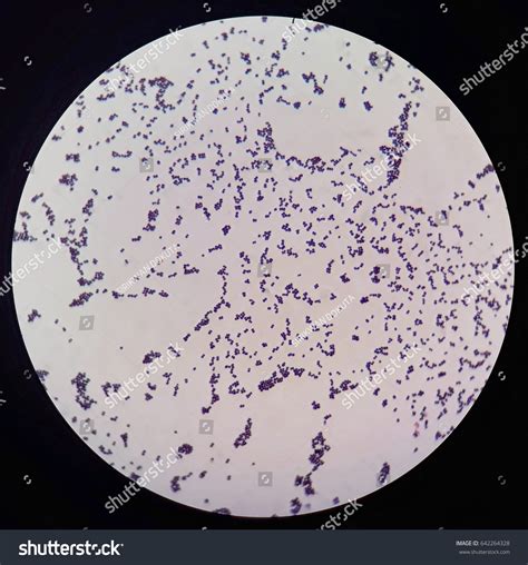 Smear Grams Stained Gram Positive Cocci Stock Photo 642264328 ...