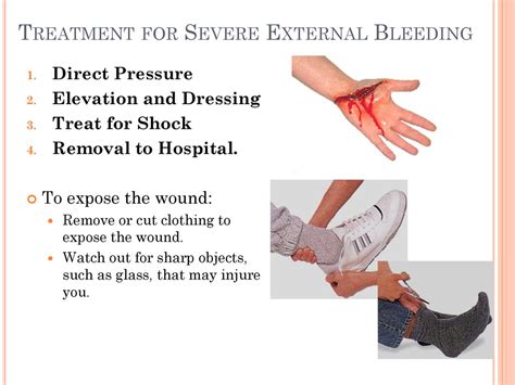 External Bleeding Treatment