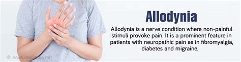 Allodynia Types Causes Symptoms Diagnosis Treatment And Risk Factors 103020 | Hot Sex Picture