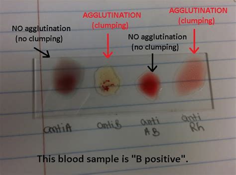 Basic Biology Lab: ABO/Rh Blood Typing - A Simple Guide