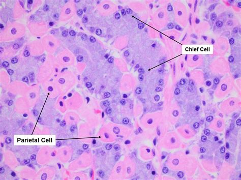 Image result for chief cells vs parietal cells histology | Anthrax disease, Poster pictures ...