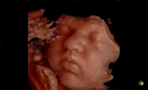 Image Gallery - Little Bellies Ultrasound 2D/3D/4D - 5D/HD & Pregnancy Spa