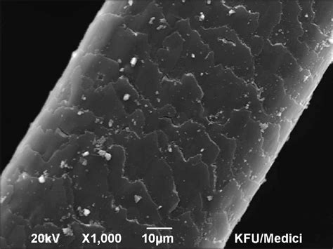 Scanning electron microscopy study of hair shaft changes related to hardness of water - Indian ...