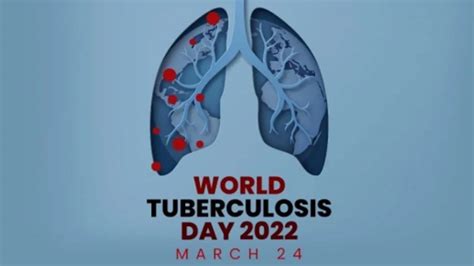 World Tuberculosis Day 2022: Date, theme, history, significance of the ...