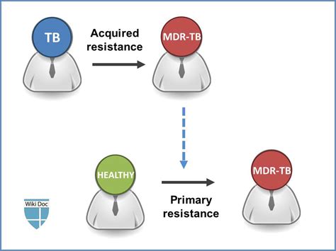 Multi-drug-resistant tuberculosis natural history, complications and ...