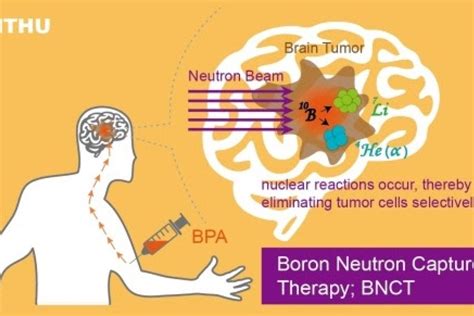 NTHU’s Boron Neutron Capture Therapy Center begins treating overseas brain cancer patients ...