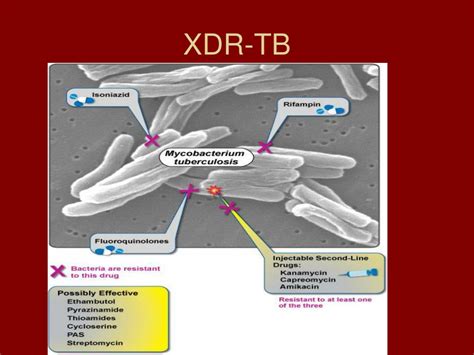 PPT - Multi-drug Resistant Tuberculosis MDR-TB Leah Erenrich Advisor: Dr. Rapp PowerPoint ...