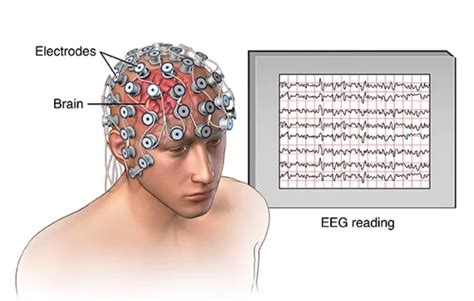 EEG | EMG | NCV Tests in Ahmedabad | Dr. Barad's Clinic